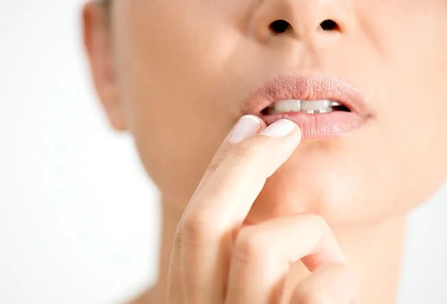 Fordyce Spots – Causes, Treatment & Expert Dermatology Care