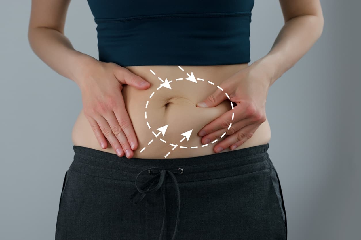 VASER Liposuction in London: A Full Breakdown of Treatable Areas & Pricing Packages