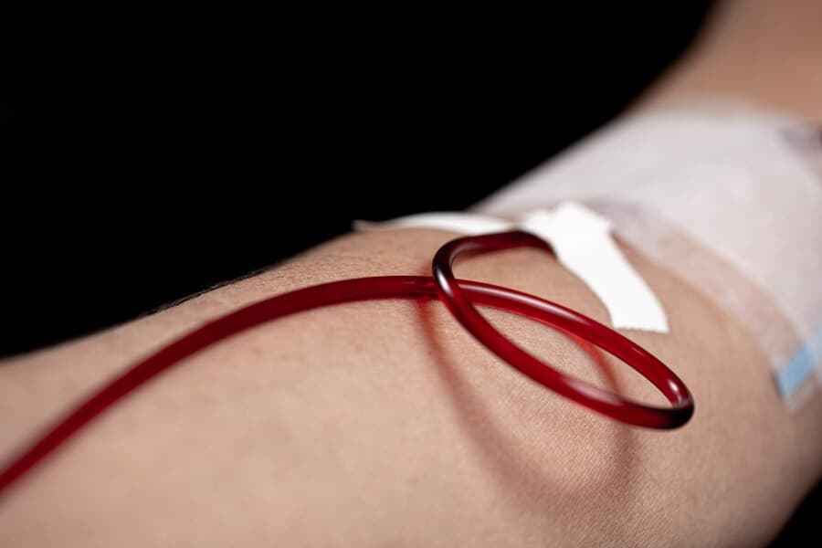 Intravenous (IV) Iron Treatment in London and Surrey: Fast Relief for Iron and Ferritin Deficiency